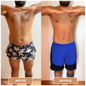 Antes e depois clnica performance Estética facial, Tratamentos corporais, preenchimentos, Massagens terapêuticas, Rejuvenescimento, Remoção de pelos, Contorno corporal, Terapias de bem-estar, Anti-envelhecimento, Estética avançada e muito mais procedimentos estéticos e saúde para seu corpo.