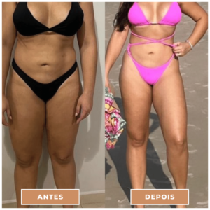 Antes e depois clnica performance Estética facial, Tratamentos corporais, preenchimentos, Massagens terapêuticas, Rejuvenescimento, Remoção de pelos, Contorno corporal, Terapias de bem-estar, Anti-envelhecimento, Estética avançada e muito mais procedimentos estéticos e saúde para seu corpo.